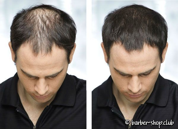 Загусник для волосся Immetee (28 грам, всі кольори) Immetee все цвета фото