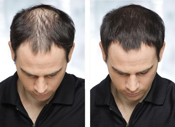 Кератиновий загусник для рідкого волосся Toppik 12 г. medium brown medium brown 12 фото